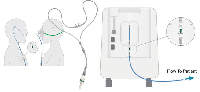 OxySafe Patient and Concentrator Set-up