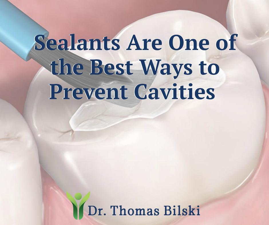 Sealants Are One of the Best Ways to Prevent Cavities