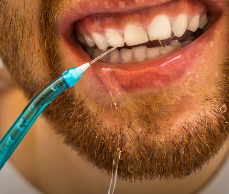 Optimal Oral Hygiene: Brushing, Flossing, and Waterpik Tips
