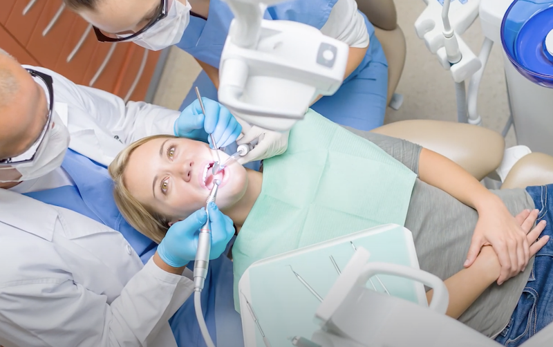 Are Dental Veneers Permanent? Image
