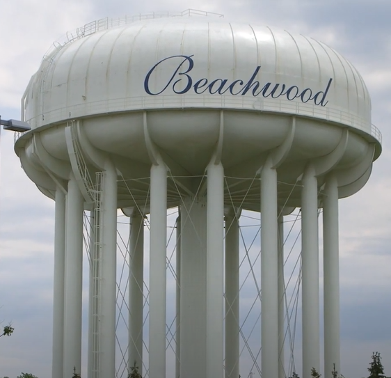 Dental Services For Beachwood, OH Residents