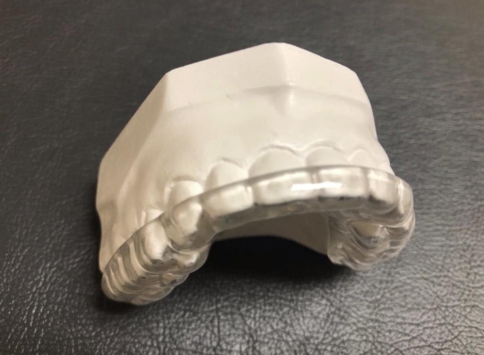 bite splint to treat bruxism at Coshocton Dentistry