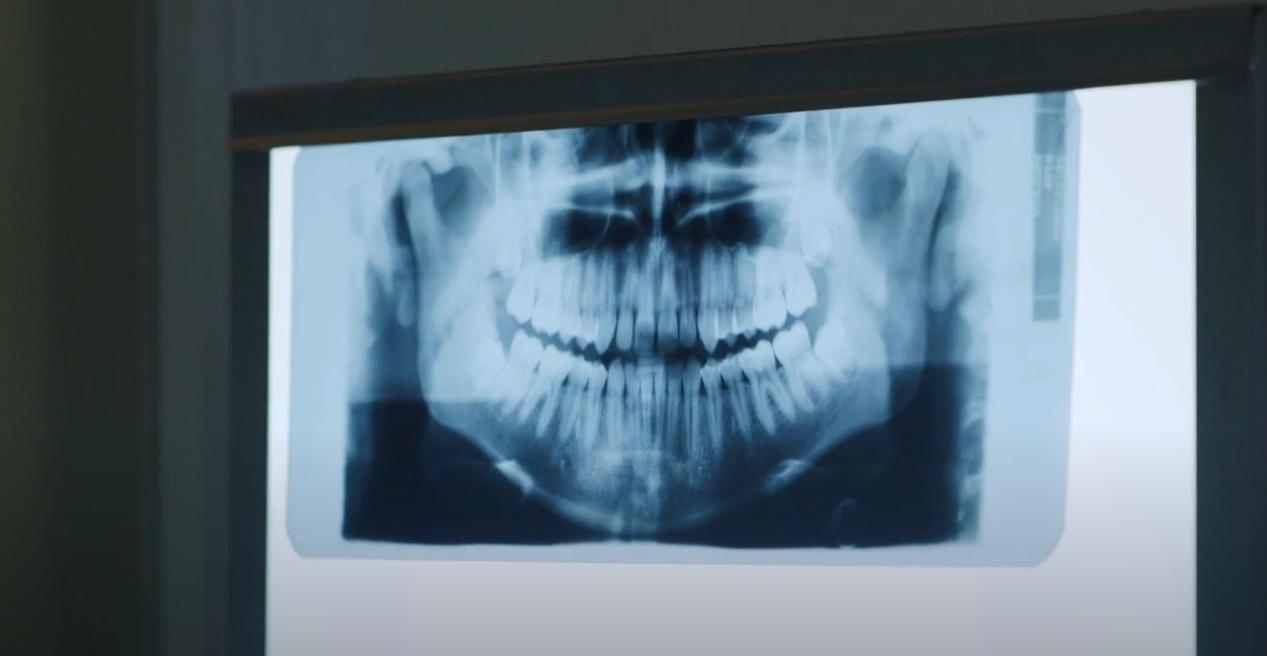 Understanding Dental X Rays