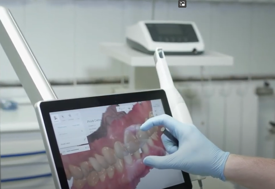 Transforming Dental Care with Digital Impressions: The Coshocton Dentistry Advantage