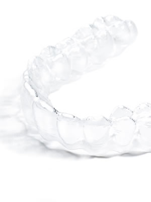 Straighten Your Smile With Clear Aligners