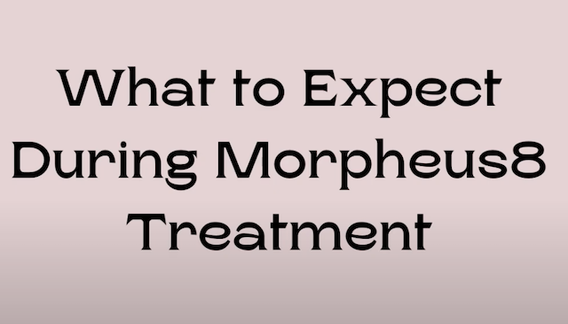 What To Expect During A Morpheus8 Treatment